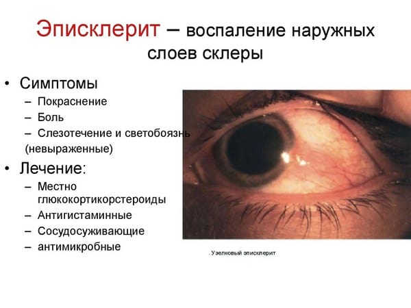 Болезни глаз у человека список заболеваний