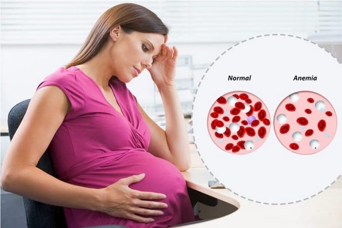 Низкий гемоглобин при беременности