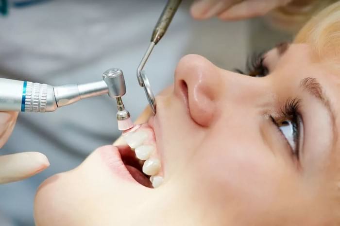 Как убрать налет на зубах: причины появления