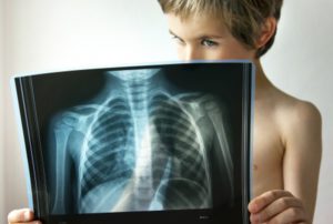 рентген легких ребенка 