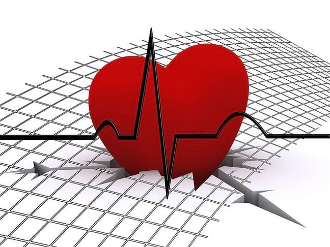 Сильное сердцебиение: причины, что делать и как этого избежать