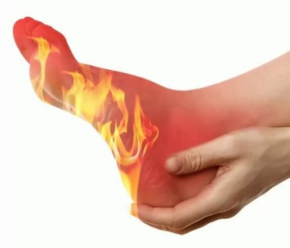 Почему горят стопы ног и народные способы лечения