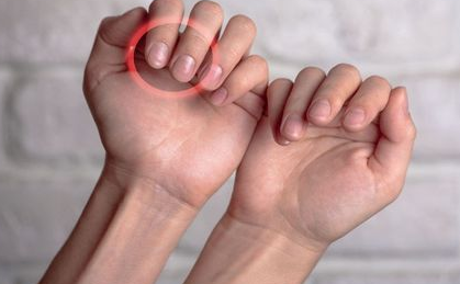 причины волнистых ногтей