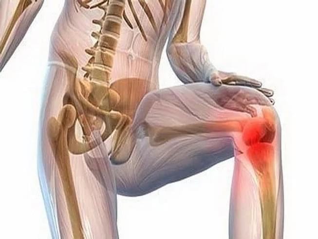 как лечить артрит коленного сустава