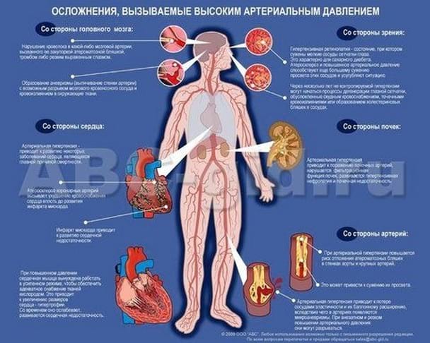 Симптомы и рекомендации по лечению артериальной гипертензии